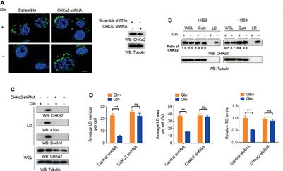 Choline Kinase Alpha2 Promotes Lipid Droplet Lipolysis in Non-Small-Cell Lung Carcinoma